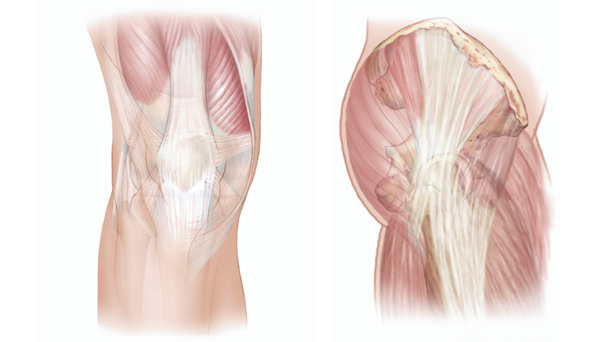 Surgical Approaches to Knee and Hip Replacement
