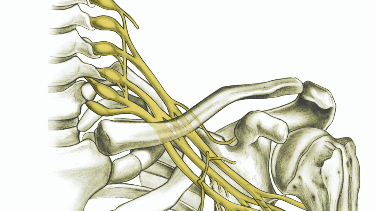 Brachial Plexus Traumatic Nerve Injuries