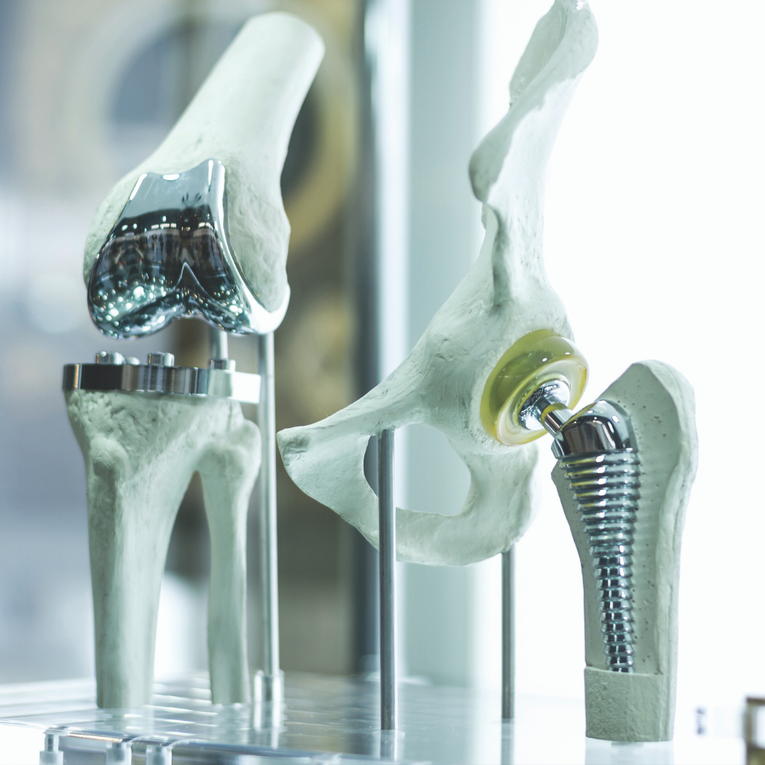 Total Joint Replacement Advances