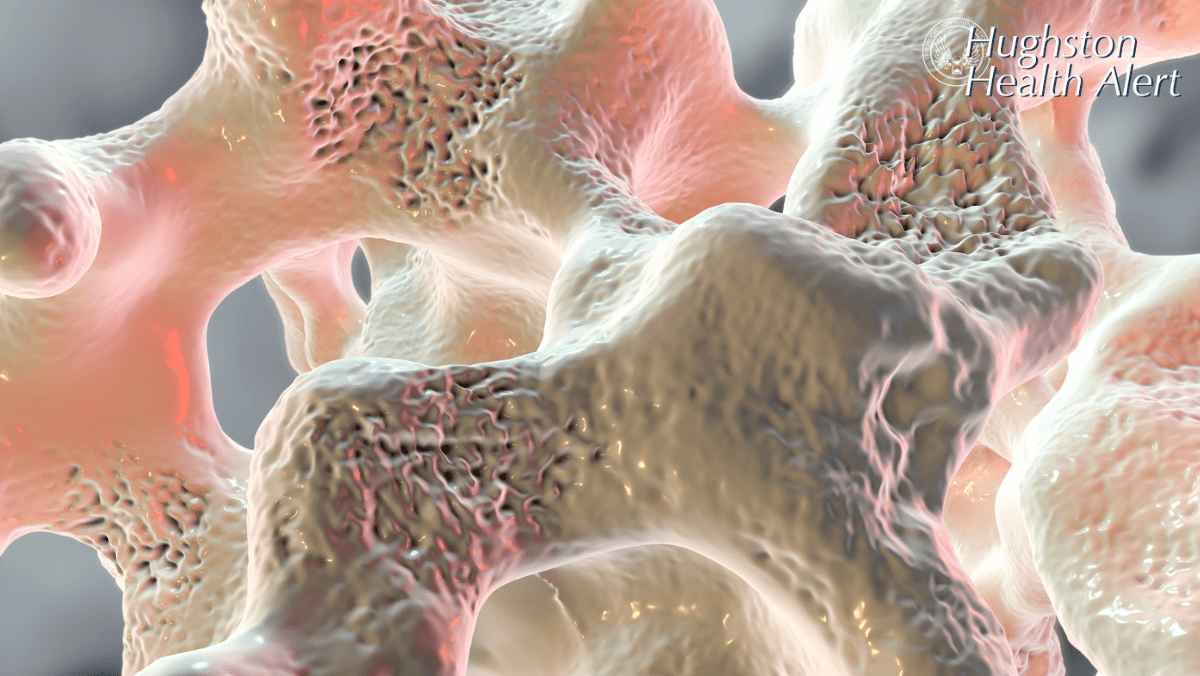 Osteoporosis
